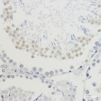 Immunohistochemistry of paraffin-embedded Rat testis using TriMethyl-Histone H4-K20 Polyclonal Antibody at dilution of 1:200 (40x lens) .