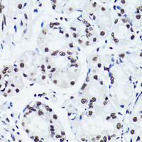 Immunohistochemistry of paraffin-embedded Human stomach using Symmetric DiMethyl-Histone H3-R2 Polyclonal Antibody at dilution of 1:100 (40x lens) .