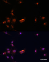 Immunofluorescence analysis of C6 cells using BRCA2 Polyclonal Antibody at dilution of 1:100. Blue: DAPI for nuclear staining.