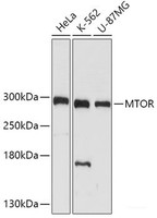 Western blot analysis of extracts of various cell lines using mTOR Polyclonal Antibody at dilution of 1:1000.