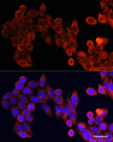 Immunofluorescence analysis of HeLa cells using mTOR Polyclonal Antibody at dilution of 1:100. Blue: DAPI for nuclear staining.