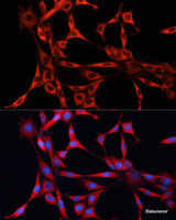 Immunofluorescence analysis of NIH/3T3 cells using mTOR Polyclonal Antibody at dilution of 1:100. Blue: DAPI for nuclear staining.