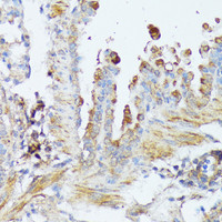 Immunohistochemistry of paraffin-embedded Mouse lung using WNT1 Polyclonal Antibody at dilution of 1:100 (40x lens) .