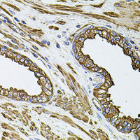 Immunohistochemistry of paraffin-embedded Human prostate using FLNB Polyclonal Antibody at dilution of 1:100 (40x lens) .