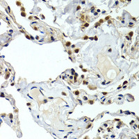 Immunohistochemistry of paraffin-embedded Human normal lung using GTF2F1 Polyclonal Antibody at dilution of 1:200 (40x lens) .