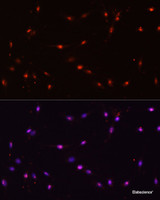 Immunofluorescence analysis of C6 cells using ILF3 Polyclonal Antibody at dilution of 1:100. Blue: DAPI for nuclear staining.