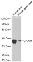 Western blot analysis of extracts of various cell lines using GNAO1 Polyclonal Antibody at dilution of 1:1000.