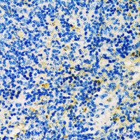 Immunohistochemistry of paraffin-embedded Mouse spleen using TIM-3/HAVCR2 Polyclonal Antibody at dilution of 1:200 (40x lens) .