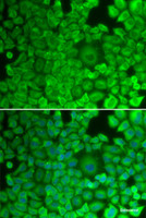 Immunofluorescence analysis of HeLa cells using GYS1 Polyclonal Antibody