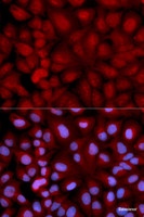 Immunofluorescence analysis of U2OS cells using SNCG Polyclonal Antibody