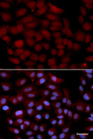 Immunofluorescence analysis of U2OS cells using TNK2 Polyclonal Antibody