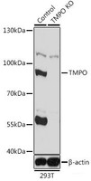Western blot analysis of extracts from normal (control) and TMPO knockout (KO) 293T cells using TMPO Polyclonal Antibody at dilution of 1:1000.