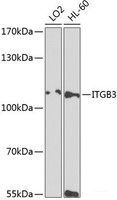 Western blot analysis of extracts of various cell lines using ITGB3 Polyclonal Antibody at dilution of 1:1000.