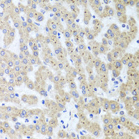 Immunohistochemistry of paraffin-embedded Human liver damage using ADIPOQ Polyclonal Antibody at dilution of 1:100 (40x lens) .