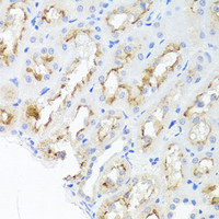 Immunohistochemistry of paraffin-embedded Rat kidney using ADIPOQ Polyclonal Antibody at dilution of 1:100 (40x lens) .