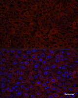 Immunofluorescence analysis of Mouse liver using CYP3A4 Polyclonal Antibody at dilution of 1:100. Blue: DAPI for nuclear staining.