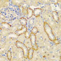 Immunohistochemistry of paraffin-embedded Rat kidney using MT1-MMP Polyclonal Antibody at dilution of 1:100 (40x lens) .