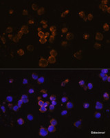 Immunofluorescence analysis of Jurkat cells using RANKL Polyclonal Antibody at dilution of 1:100. Blue: DAPI for nuclear staining.