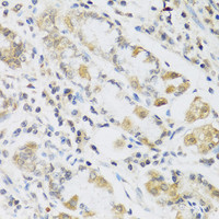 Immunohistochemistry of paraffin-embedded Human stomach using RETN Polyclonal Antibody at dilution of 1:100 (40x lens) .