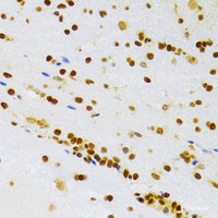 Immunohistochemistry of paraffin-embedded Rat brain using HMGB1 Polyclonal Antibody at dilution of 1:100 (40x lens) .