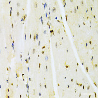 Immunohistochemistry of paraffin-embedded Mouse heart using HMGB1 Polyclonal Antibody at dilution of 1:100 (40x lens) .