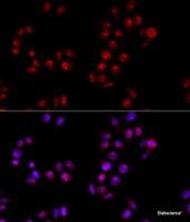 Immunofluorescence analysis of HeLa cells using HMGB1 Polyclonal Antibody at dilution of 1:100 (40x lens) . Blue: DAPI for nuclear staining.