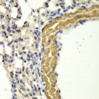 Immunohistochemistry of paraffin-embedded Mouse lung using PRKG1 Polyclonal Antibody at dilution of 1:100 (40x lens) .
