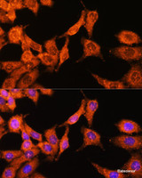 Immunofluorescence analysis of HeLa cells using N-WASP Polyclonal Antibody at dilution of 1:100 (40x lens) . Blue: DAPI for nuclear staining.