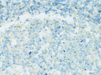 Immunohistochemistry of paraffin-embedded Human vermiform appendix using CD19 Polyclonal Antibody at dilution of 1:100 (40x lens) .