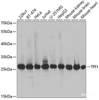 Western blot analysis of extracts of various cell lines using TPI1 Polyclonal Antibody at dilution of 1:1000.