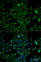 Immunofluorescence analysis of HeLa cells using TPI1 Polyclonal Antibody