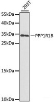 Western blot analysis of extracts of 293T cells using PPP1R1B Polyclonal Antibody at dilution of 1:1000.