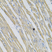 Immunohistochemistry of paraffin-embedded Rat heart using PRNP Polyclonal Antibody at dilution of 1:100 (40x lens) .