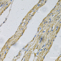 Immunohistochemistry of paraffin-embedded Human smooth muscle using PRNP Polyclonal Antibody at dilution of 1:100 (40x lens) .