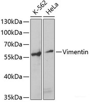 Western blot analysis of extracts of various cell lines using Vimentin Polyclonal Antibody at dilution of 1:1000.