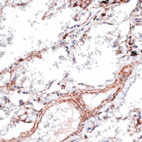 Immunohistochemistry of paraffin-embedded Human lung using Vimentin Polyclonal Antibody at dilution of 1:100 (40x lens) .