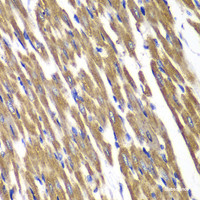 Immunohistochemistry of paraffin-embedded Rat heart using SDHA Polyclonal Antibody at dilution of 1:100 (40x lens) .