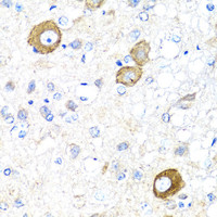 Immunohistochemistry of paraffin-embedded Rat brain using NRG4 Polyclonal Antibody at dilution of 1:100 (40x lens) .
