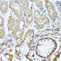 Immunohistochemistry of paraffin-embedded Human stomach using NRG4 Polyclonal Antibody at dilution of 1:100 (40x lens) .