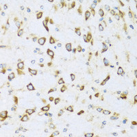 Immunohistochemistry of paraffin-embedded Mouse brain using NRG4 Polyclonal Antibody at dilution of 1:100 (40x lens) .