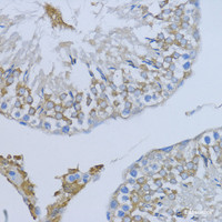 Immunohistochemistry of paraffin-embedded Rat testis using NRG4 Polyclonal Antibody at dilution of 1:200 (40x lens) .