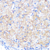 Immunohistochemistry of paraffin-embedded Rat ovary using Occludin Polyclonal Antibody at dilution of 1:100 (40x lens) .