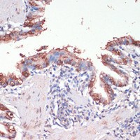 Immunohistochemistry of paraffin-embedded Rat lung using MSI1 Polyclonal Antibody at dilution of 1:200 (40x lens) .