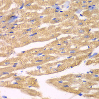 Immunohistochemistry of paraffin-embedded Mouse heart using APLP1 Polyclonal Antibody at dilution of 1:100 (40x lens) .