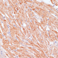 Immunohistochemistry of paraffin-embedded Rat heart using Caspase-9 Polyclonal Antibody at dilution of 1:100 (40x lens) .