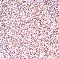 Immunohistochemistry of paraffin-embedded Human tonsil using Caspase-9 Polyclonal Antibody at dilution of 1:100 (40x lens) .