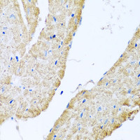 Immunohistochemistry of paraffin-embedded Mouse heart using COX6B1 Polyclonal Antibody at dilution of 1:100 (40x lens) .