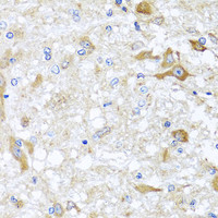 Immunohistochemistry of paraffin-embedded Rat brain using ABCB8 Polyclonal Antibody at dilution of 1:100 (40x lens) .