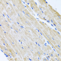 Immunohistochemistry of paraffin-embedded Mouse heart using ABCB8 Polyclonal Antibody at dilution of 1:100 (40x lens) .