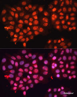 Immunofluorescence analysis of HeLa cells using ABCB8 Polyclonal Antibody at dilution of 1:100 (40x lens) . Blue: DAPI for nuclear staining.